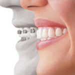 When do You Need the Services of an Emergency Dentist in Stratford?