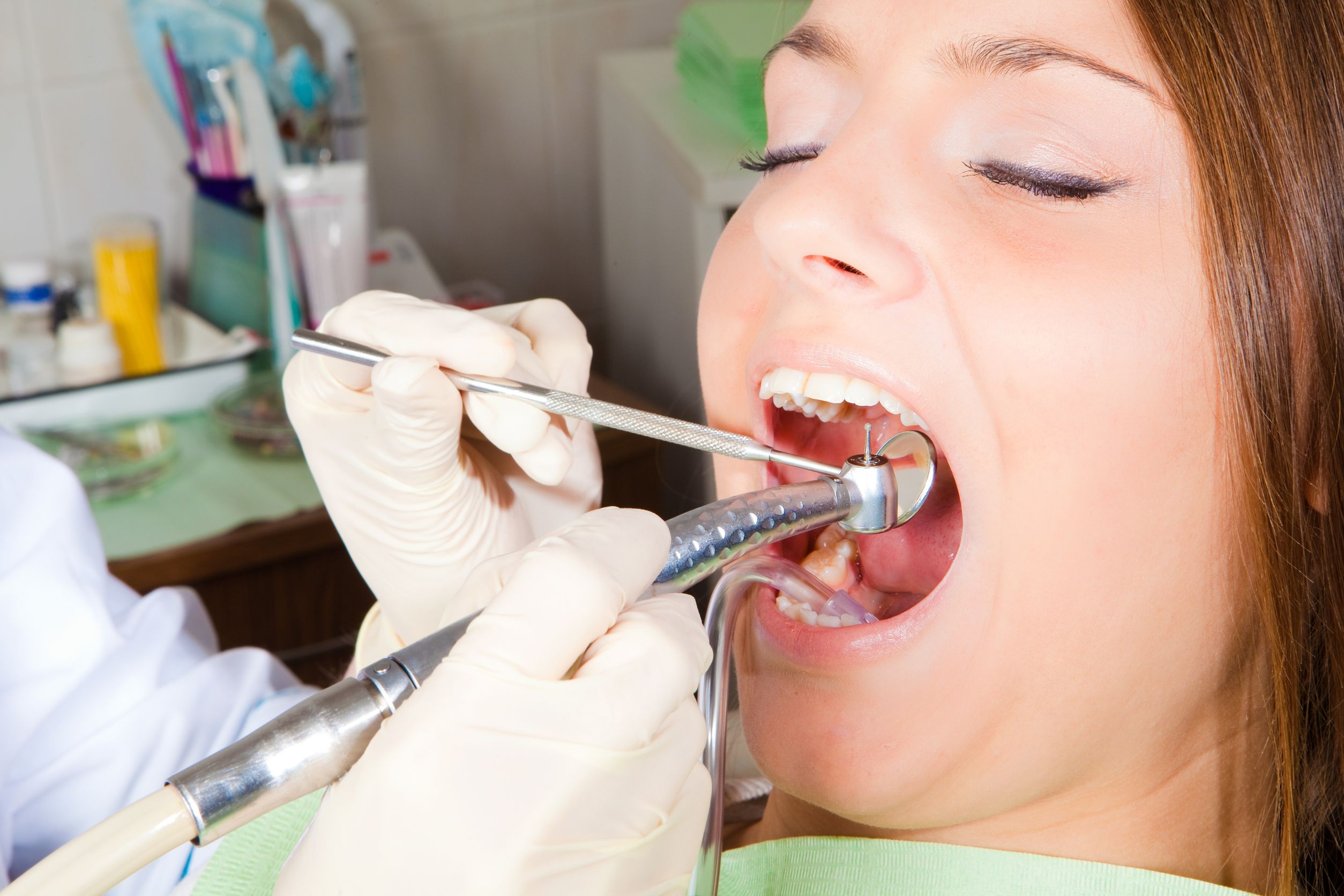 Dentistry Services: A Quick Look At Root Canals And Dental Fillings