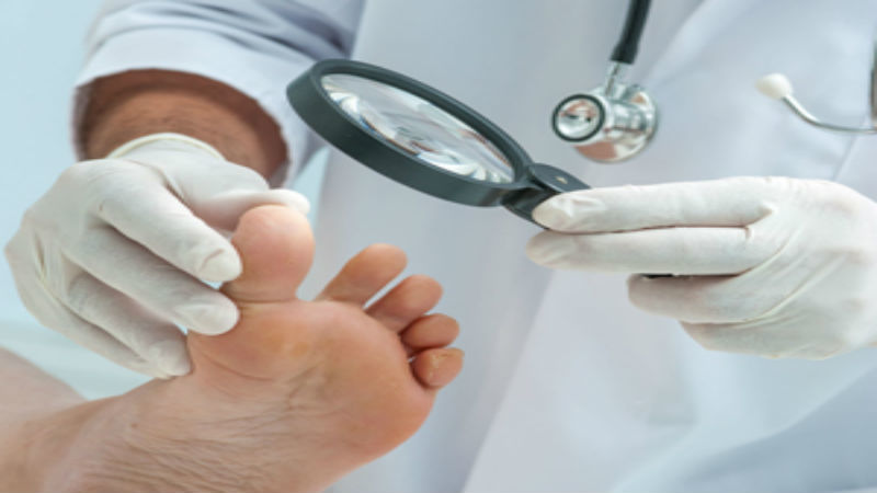 Seeking Professional Ingrown Toenails Treatment in Kenosha WI