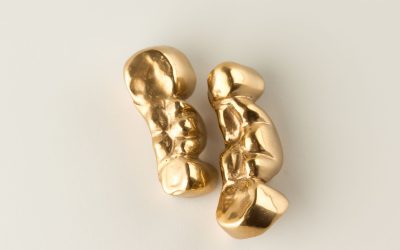 Choosing The Best Dental Gold Buyers