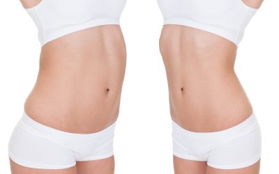 Benefits You Can Expect from Liposuction Boston MA for Lasting Confidence